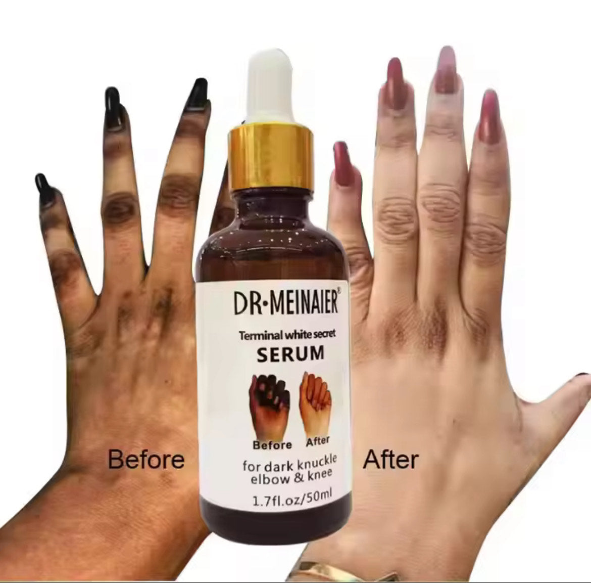 Sérum pour l'elimination des taches